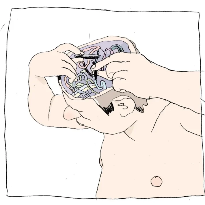 إعادة تشكيل الوصلات العصبية